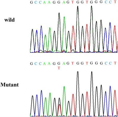 Pathogenicity and Long-Term Outcomes of Liddle Syndrome Caused by a Nonsense Mutation of SCNN1G in a Chinese Family